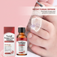 🎉 2026 Sale — Over 32,400 Sold!💅🏻2‑Bottle Damaged Nail Repair Essence 🖤