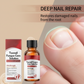 🎉 2026 Sale — Over 32,400 Sold!💅🏻2‑Bottle Damaged Nail Repair Essence 🖤