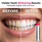 🔥Limited Time Promotion 50% OFF🔥Advanced Stain-Removing Whitening Mouthwash